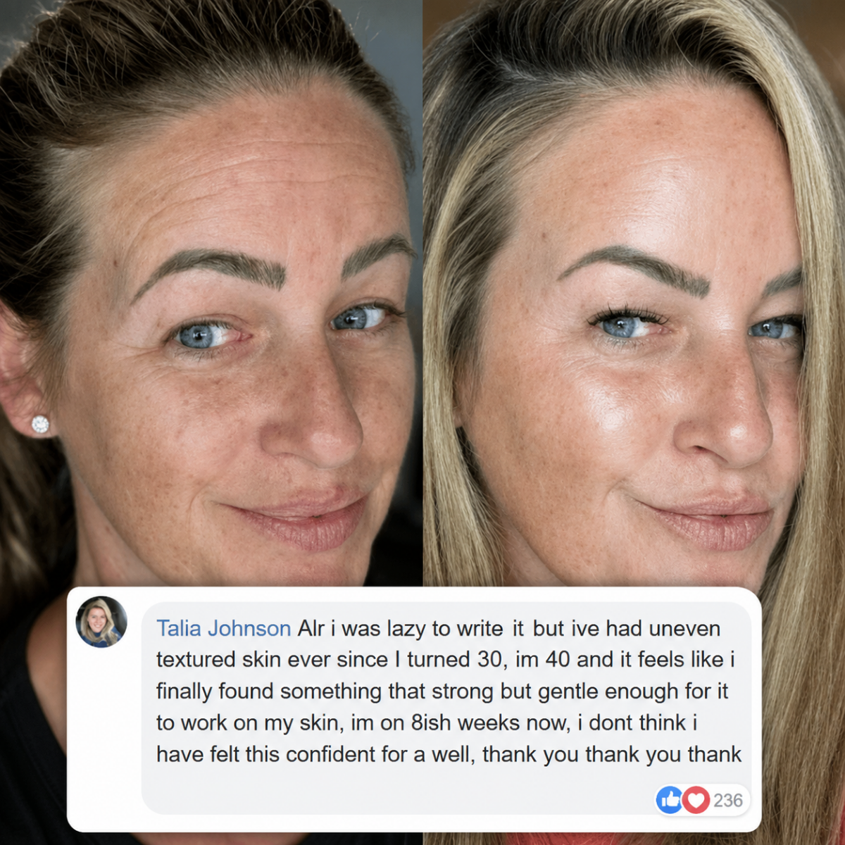 Hollisticare 100% Volufiline Serum