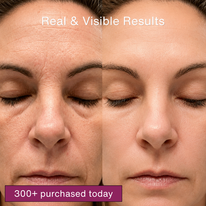 Hollisticare 100% Volufiline Serum